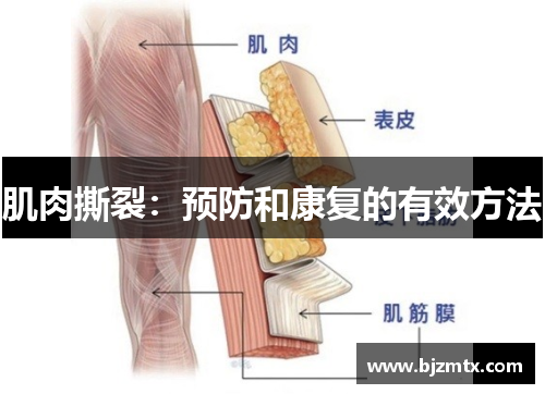 肌肉撕裂：预防和康复的有效方法